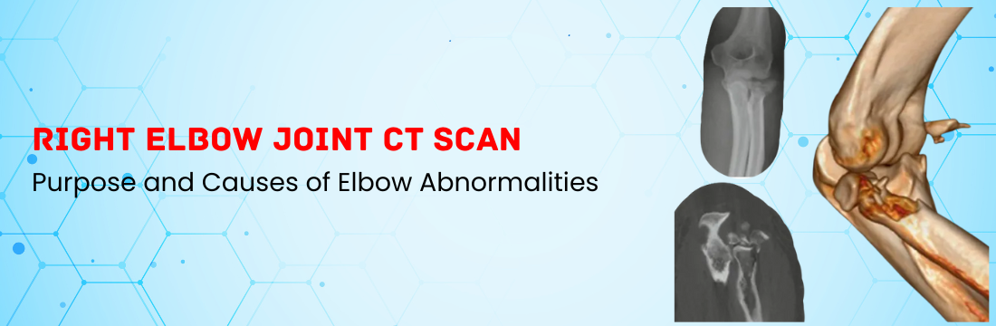 Right Elbow joint CT Scan: Purpose and Causes of Elbow Abnormalities